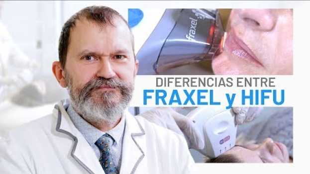 Video ¿Ultrasonidos HIFU o Láser Fraxel? Escoge el MEJOR Rejuvenecimiento su italiano