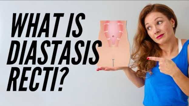 Video Diastasis Recti Symptoms Of Mummy Tummy (DOES YOUR BELLY LOOK LIKE THIS?) auf Deutsch