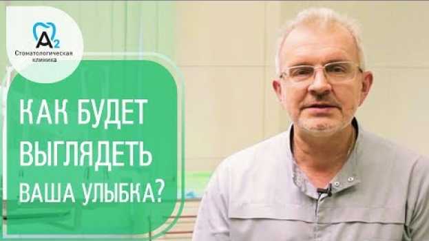 Video Цифровой дизайн улыбки. 😍 Цифровой дизайн улыбки - результат лечения уже на первом посещении. 12+ en français