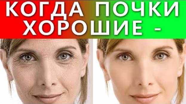 Video КОГДА ПОЧКИ ХОРОШИЕ - ЛИЦО КРАСИВОЕ, МОРЩИН НЕТ, ЭТО И ЕСТЬ САЛОН КРАСОТЫ! Очищение почек Болотов in English