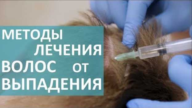Video Трихолог о выпадении волос. 💇 Врач - трихолог расскажет о методах лечения выпадения волос. em português