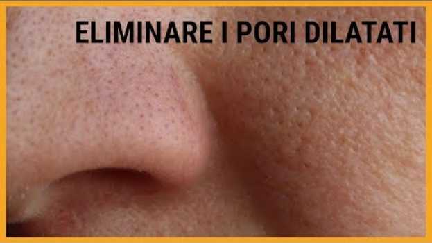 Video ♡ Come ELIMINARE I PORI DILATATI dal viso ♡   türkçe