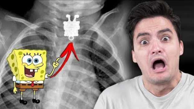 Video Coisas bizarras encontradas DENTRO de pessoas! [+10] en español