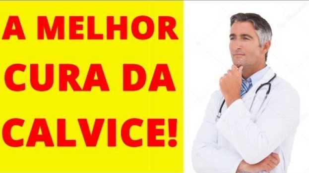 Видео Como Combater A Calvice - Descubra Agora 5 EXTRAORDINÁRIAS Dicas Para Você Combater A Calvice! на русском