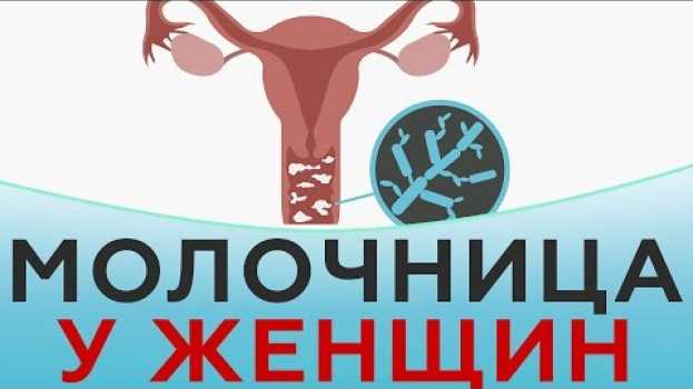 Video Молочница у женщин auf Deutsch