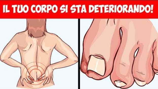 Video Alcuni segni comuni che dicono che il tuo corpo si sta lentamente deteriorando en français