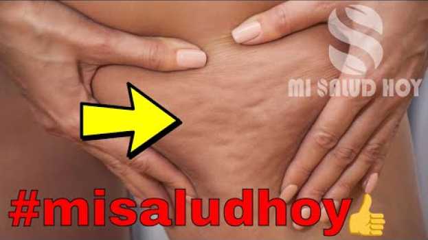 Video 🔵 Diez Artículos Que Siempre Usas Y Te Provocan Celulitis su italiano