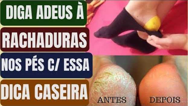Video Basta Fazer ISSO A NOITE e Adeus CALOS e RACHADURAS NOS PÉS com CASCA DE LIMÃO!!   türkçe