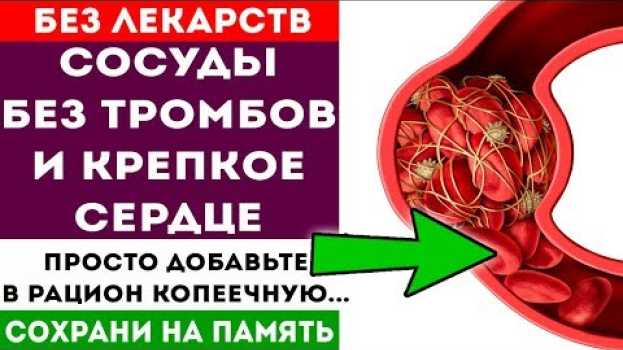 Video У вас не будет тромбов, если добавите в рацион эту копеечную... 🌿 Народная медицина en español