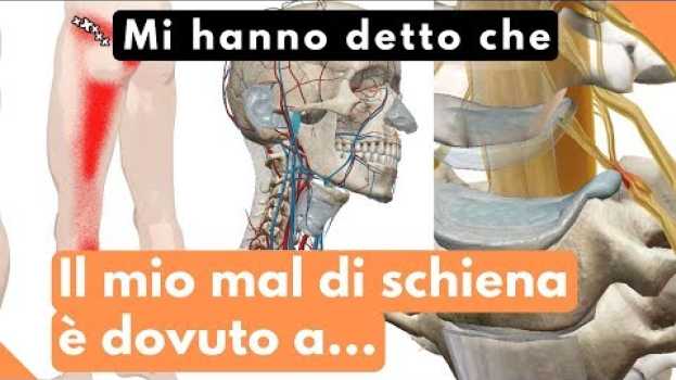 Video Mi hanno detto che il mio mal di schiena è dovuto a   türkçe