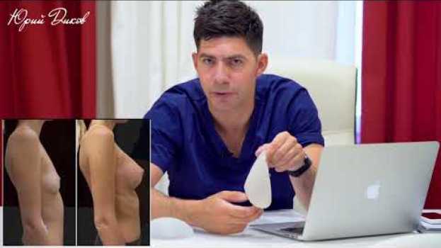 Video Грудные импланты - какими они бывают? #пластическийхирург   türkçe