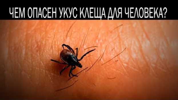 Video Чем опасен укус клеща для человека en español