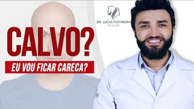Video Será que eu vou ficar Calvo? Meu cabelo esta caindo | Calvície | Dr Lucas Fustinoni su italiano