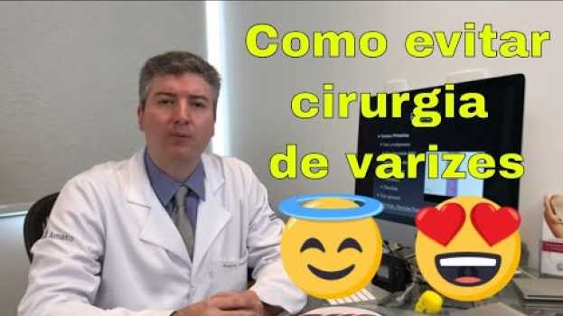 Video Como evitar uma nova cirurgia de varizes após cirurgia?   türkçe