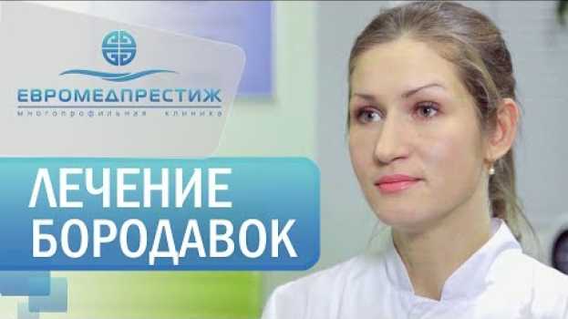 Video Виды бородавок. 🐸 Виды бородавок, папиллом и их эффективное лечение. Клиника Евромедпрестиж em português