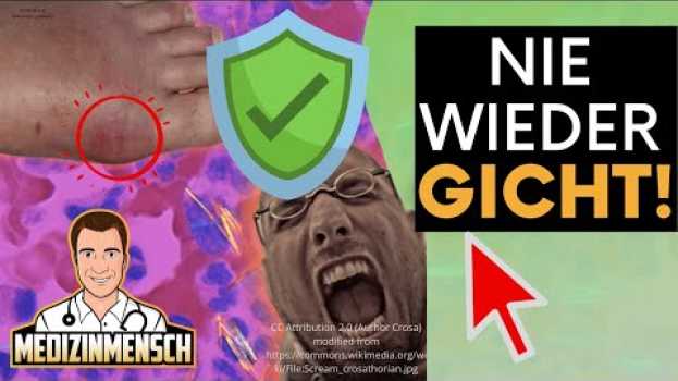 Video Nie wieder GICHT-Fuß! Harnsäure senken, Schmerzen vermeiden! (Arzt erklärt) po polsku