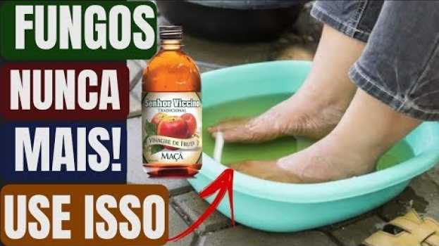 Video Coloque Seus PÉS em uma Bacia Com Vinagre de Maçã, Você Vai AMAR o Resultado! po polsku