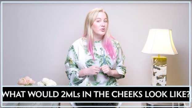 Video What would I look like if I have just 2ml's of filler in my cheeks? em português