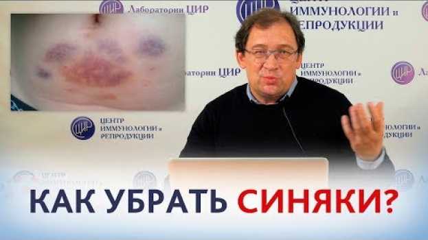 Video Уколы гепарина. КАК УБРАТЬ СИНЯКИ от уколов гепарина или клексана? Отвечает доктор Гузов. in English