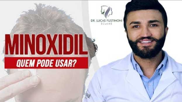 Video 🤔 MINOXIDIL: Quem pode usar? Posso usar? | Dr Lucas Fustinoni   türkçe