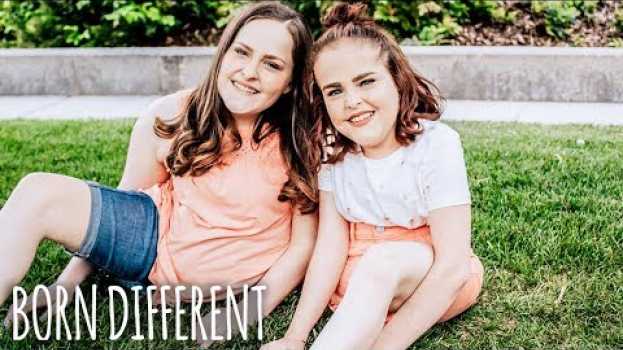 Video The Twins That Were Cut In Half | BORN DIFFERENT su italiano