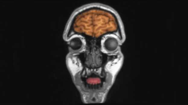 Video A Boy Ate Only Chips And French Fries For 10 Years. This Is What Happened To His Eyes. po polsku