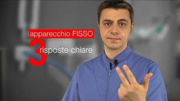 Video 3 risposte chiare sull' apparecchio fisso (senza girarci intorno) po polsku