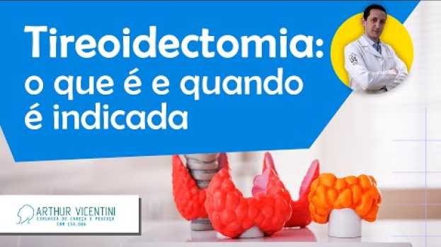 Video Tireoidectomia: o que é e quando é indicada | Dr. Arthur Vicentini CRM 154.086 en español