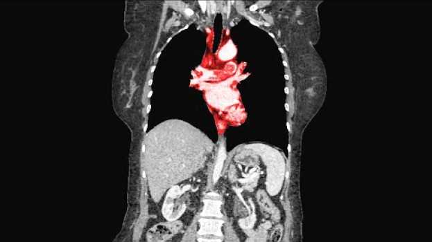 Video A Man Played Video Games Nonstop For 73 Hours. This Is What Happened To His Organs. em Portuguese