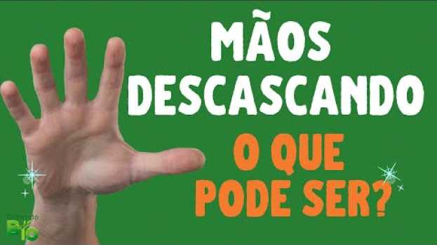 Video MÃOS DESCASCANDO:  o que pode ser? [NÃO IGNORE] su italiano
