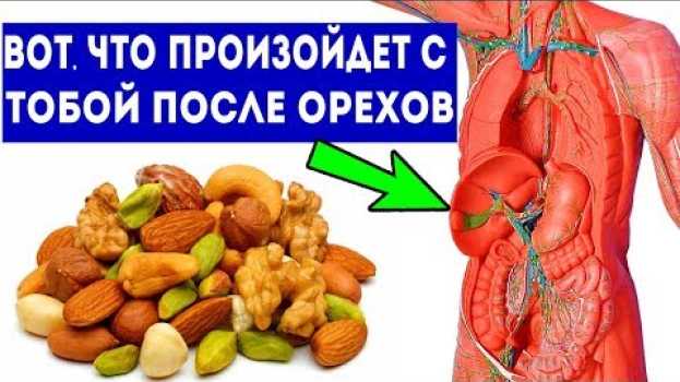 Video Вот что случится, если орехи кушать каждый день (10 причин кушать орехи) po polsku