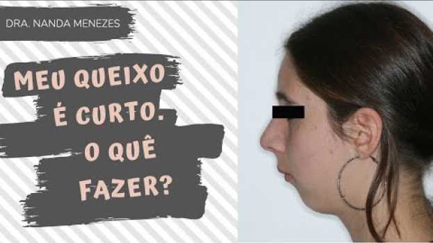 Видео Seu queixo é curto? Pode ser Classe 2 | Dra Nanda Menezes на русском