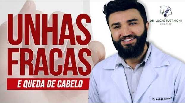 Видео UNHAS FRACAS e QUEDA DE CABELO: O que as unhas dizem sobre o cabelo ? | Dr Lucas Fustinoni на русском