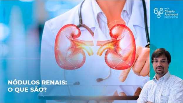 Video Nódulos Renais: O que são? | Dr. Cassio Andreoni CRM 78.546 su italiano