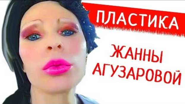 Video ЖАННУ АГУЗАРОВУ не узнать. Певица переборщила с пластикой, увеличив не только губы en français