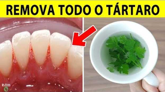 Video Isso Tira o TÁRTARO e Limpa os DENTES Muito Rápido | Receita Caseira #Tártaro en français