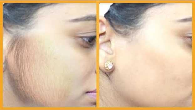 Video ♡ Come eliminare i peli dal viso - Rimedio 100% naturale ♡   türkçe