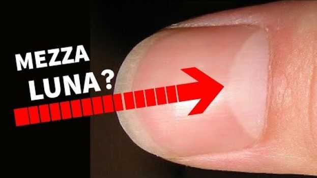 Video HAI LA LA FORMA DI MEZZA LUNA SULLE UNGHIE? GUARDA COSA SIGNIFICA auf Deutsch