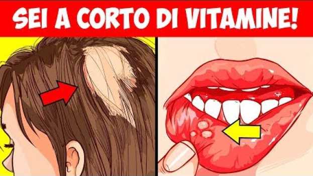 Video Gli 8 segnali di avvertimento che il tuo corpo è carente di vitamine essenziali   türkçe