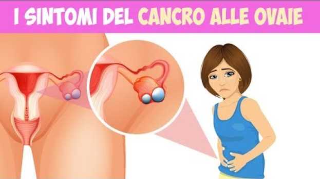 Video I 8 sintomi del cancro alle ovaie che ogni donna dovrebbe conoscere en español