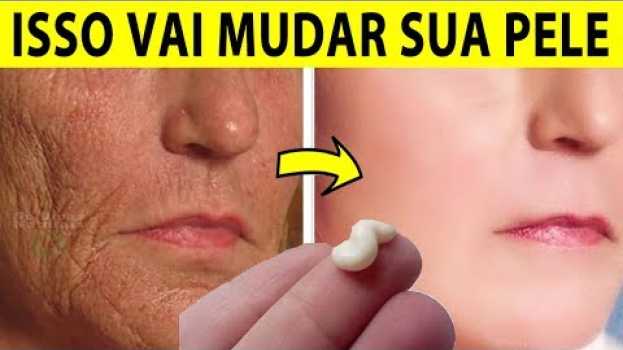 Video USE ISSO Para ELIMINAR MUITOS ANOS de RUGAS E PÉS DE GALINHA DA PELE - RECEITA CASEIRA #Rugas su italiano