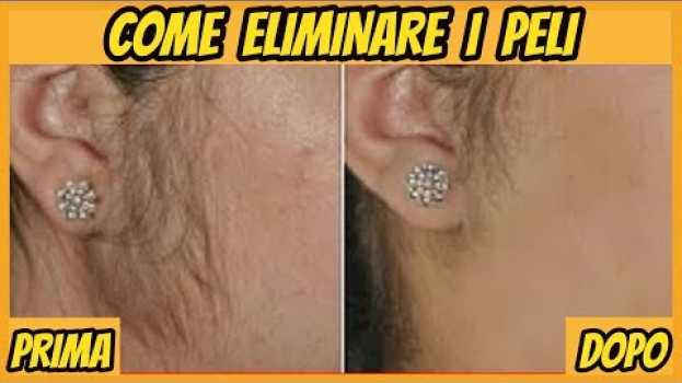 Video ♡ Come ELIMINARE i PELI sul viso - Rimedio naturale ♡ in English
