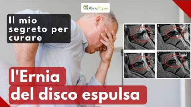 Video Il mio segreto per curare (definitivamente!!!) l'ernia del disco espulsa in English
