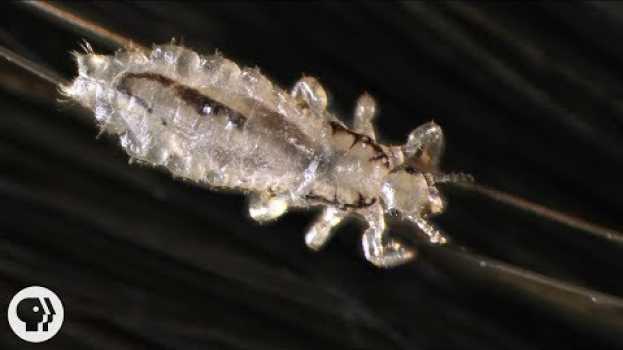 Video How Lice Turn Your Hair Into Their Jungle Gym | Deep Look em português