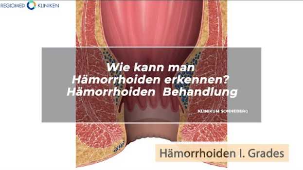 Video REGIOMED Kliniken: Wie kann man Hämorrhoiden erkennen? Hämorrhoiden Behandlung em português