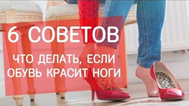 Video Что делать, если обувь красит ноги? Советы от экспертов Next Step su italiano