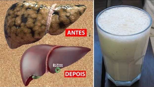 Video Receita Caseira que Ajuda Limpar a GORDURA DO FÍGADO - Só Dicas Naturais su italiano