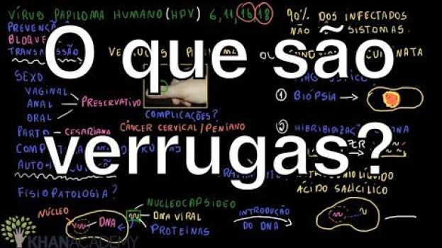 Video O que são verrugas? | Vida e evolução | Khan Academy   türkçe