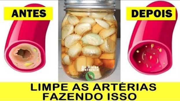 Video Esta Receita SUGA A GORDURA das Veias Igual Aspirador Suga Poeira en français