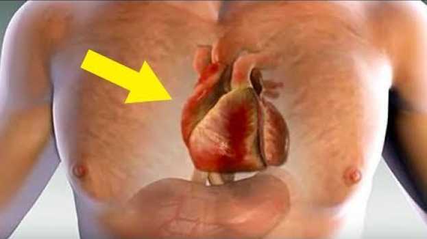 Video Un Mese Prima Di Un Infarto, Il Tuo Corpo Ti Avvertirà - 14 Segni Premonitori Di Un Infarto auf Deutsch